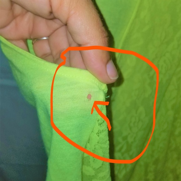 PINK by Victoria Secret Neon Yellow Tank - Picture 5 of 5